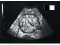 babycloud_ultraschall - Kopia.jpg